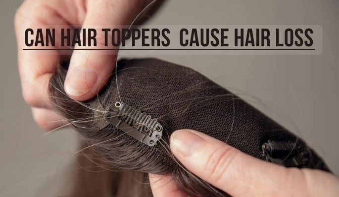 /uploads/20240407/Hair topper caused hair loss.jpg